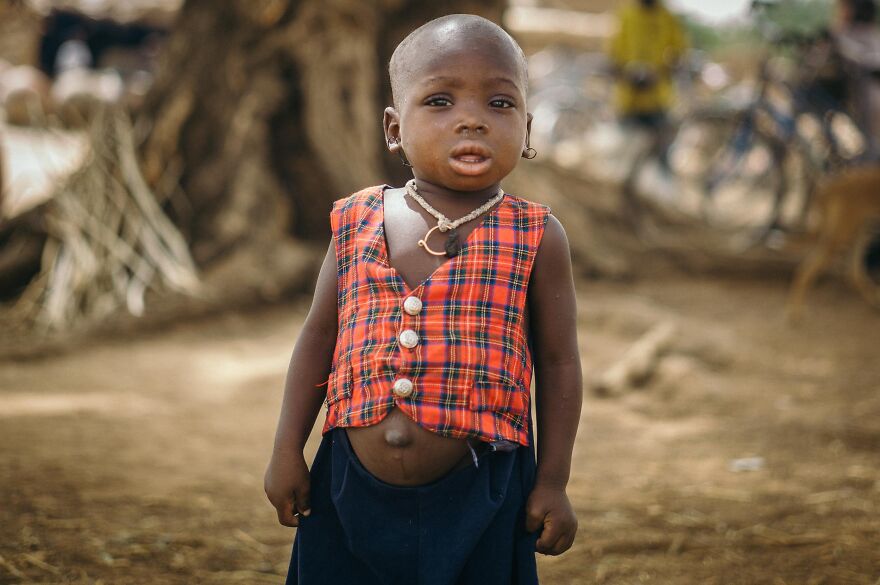 I Was Walking Around Fada Ngourma In A Hot Summer Morning