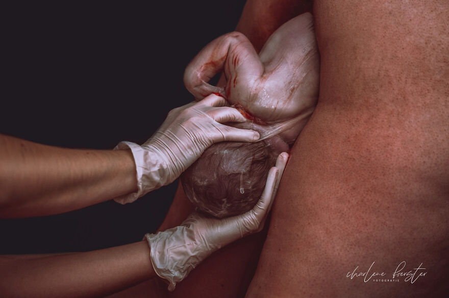 The Winners Of 2021 Birth Photography Image Competition