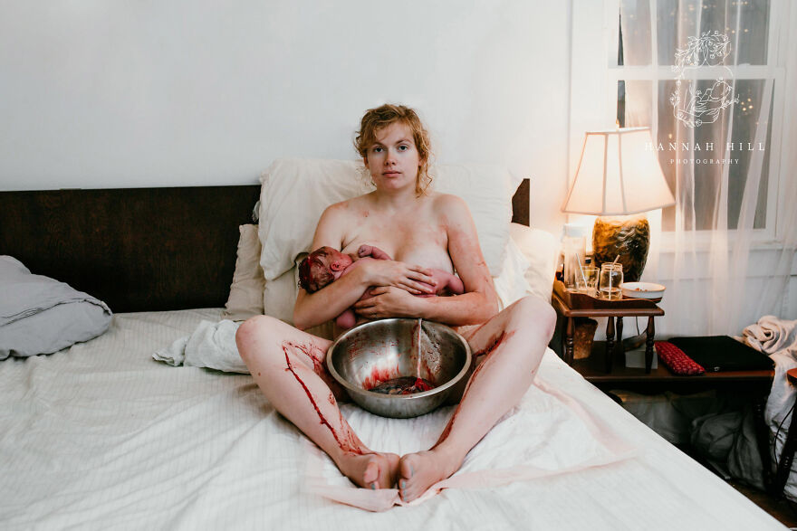 The Winners Of 2021 Birth Photography Image Competition