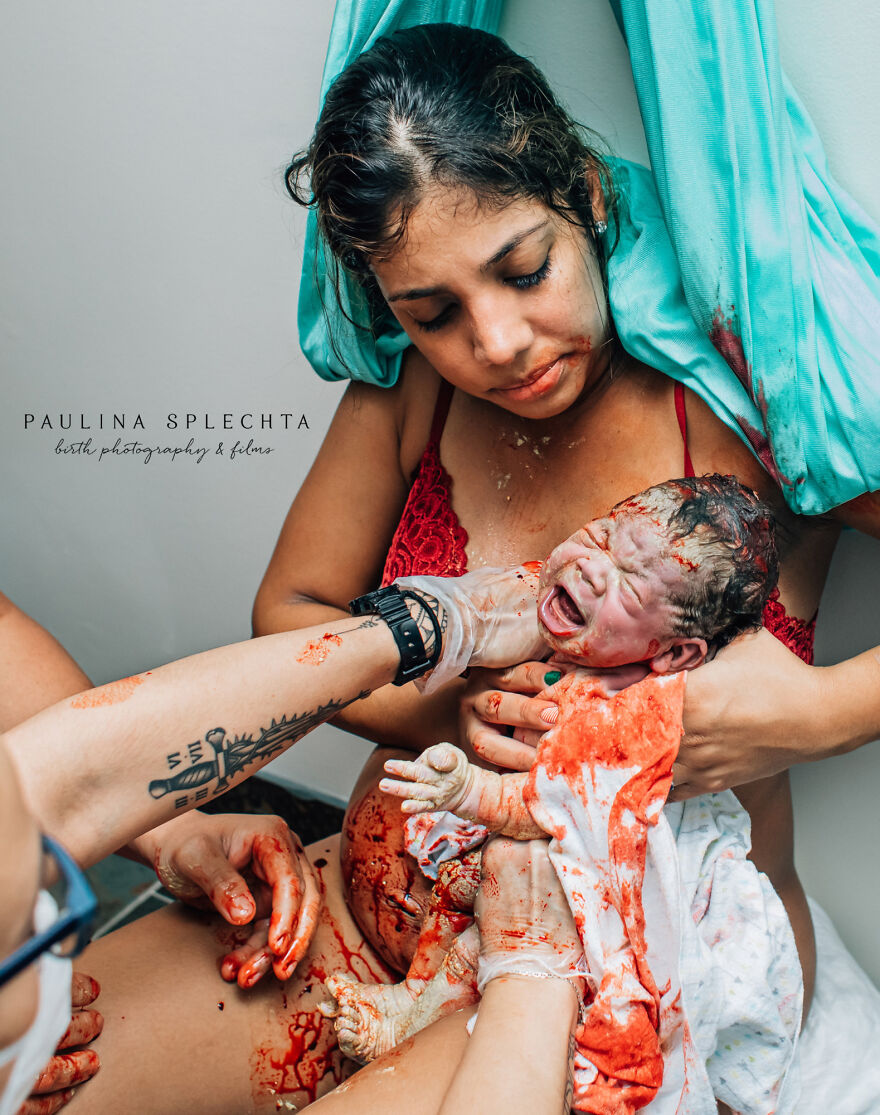 The Winners Of 2021 Birth Photography Image Competition