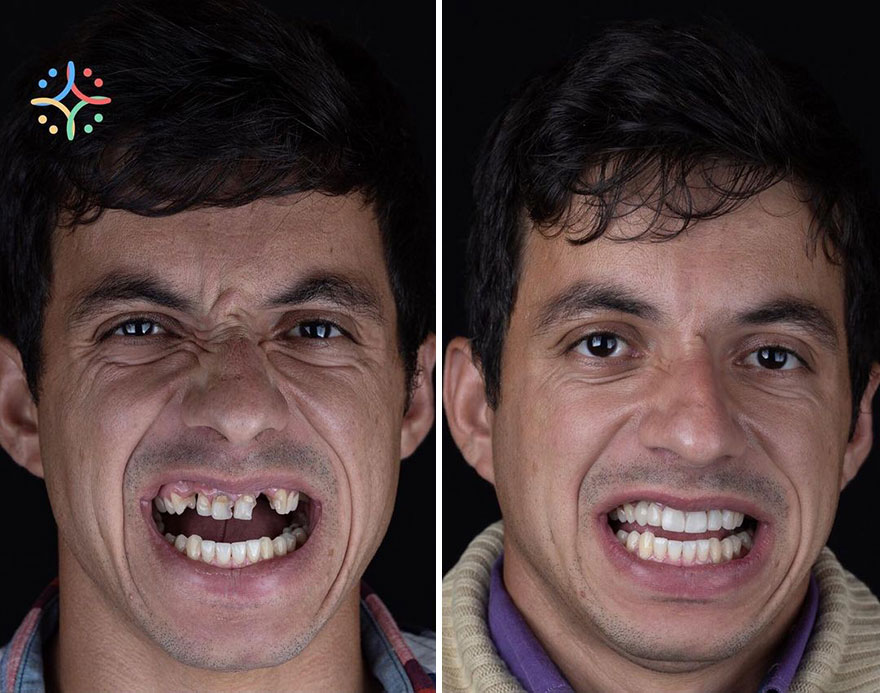 Brazilian Dentist Felipe Rossi Treat The Teeth Of Poor People