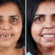 Brazilian Dentist Felipe Rossi Treat The Teeth Of Poor People: Here Are The 30 Photos Of Transformations