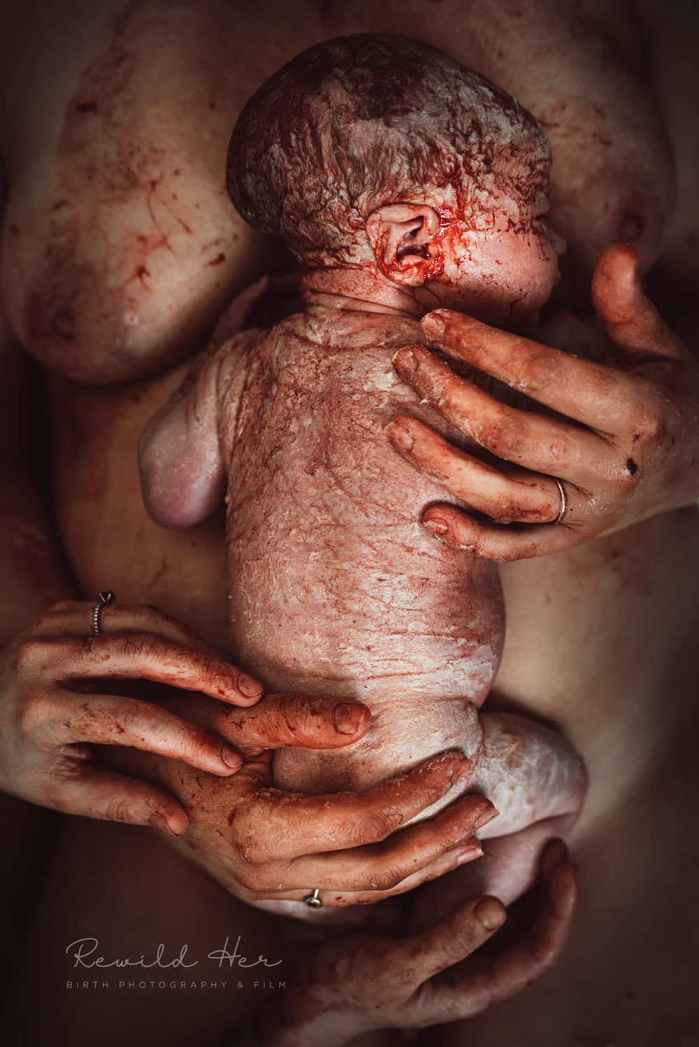 Birth Photography Image Competition Winners