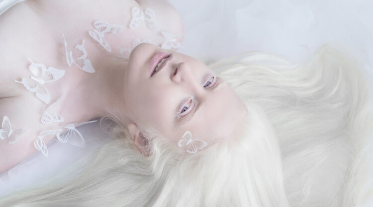 Photographer Yulia Taits Captured The Beauty Of Albino People