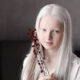 Beautiful Girl With Albinism And Heterochromia