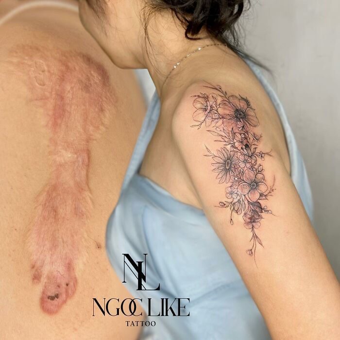 Scars Cover Up Tattoos By Tran Thi Bich Ngoc