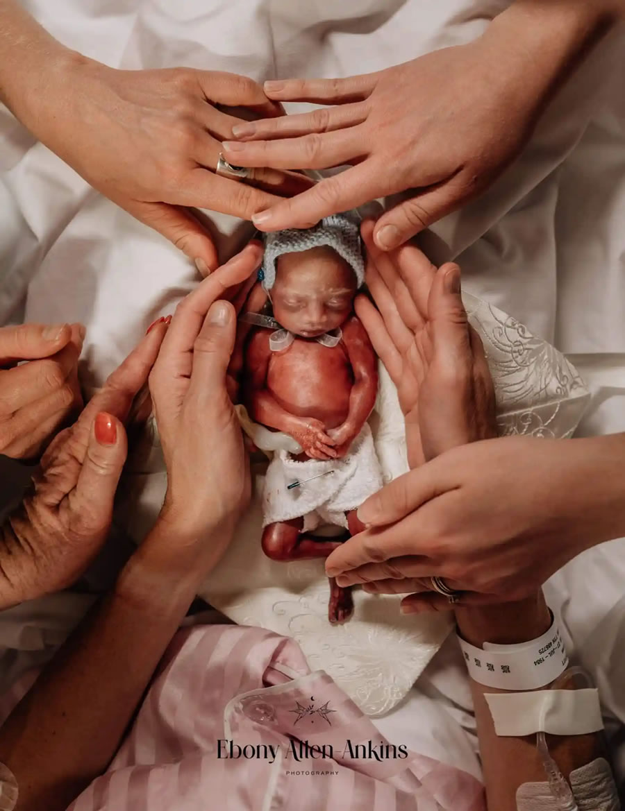 Birth Photography Image Competition Winnners