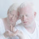 The Beauty Of Albino People