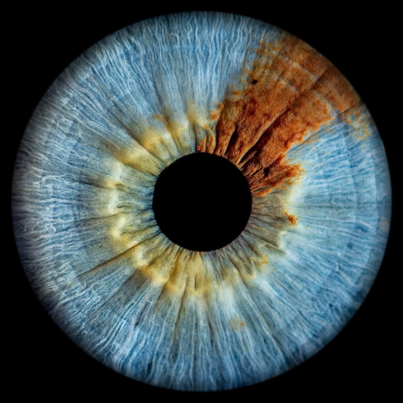 The Beauty Of The Human Eye Captured In Immense Detail By Iris Photography