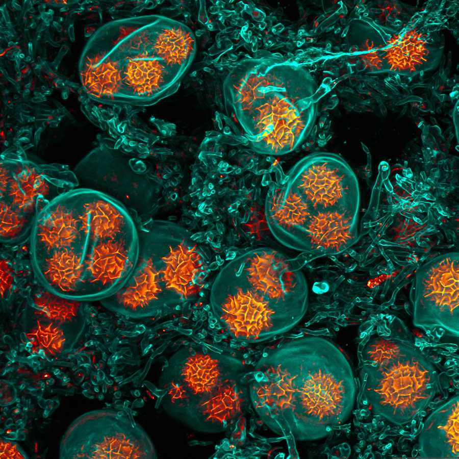 2024 Nikon Small World Photomicrography Competition Winners